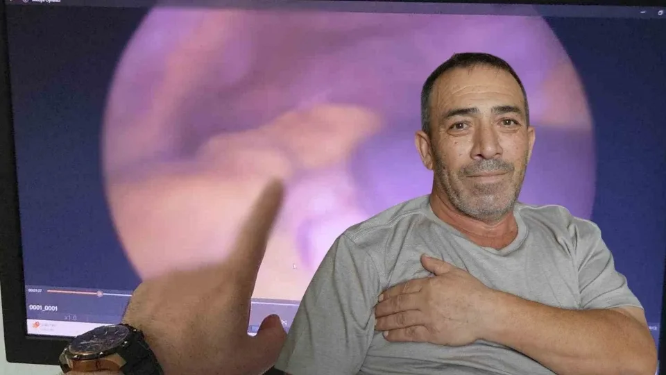 d5f3615e-bagirsak-tedavisi-icin-hastaneye-gitti-54-yil-sonra