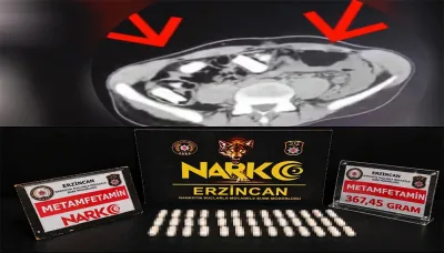 oıpoıpıopıo